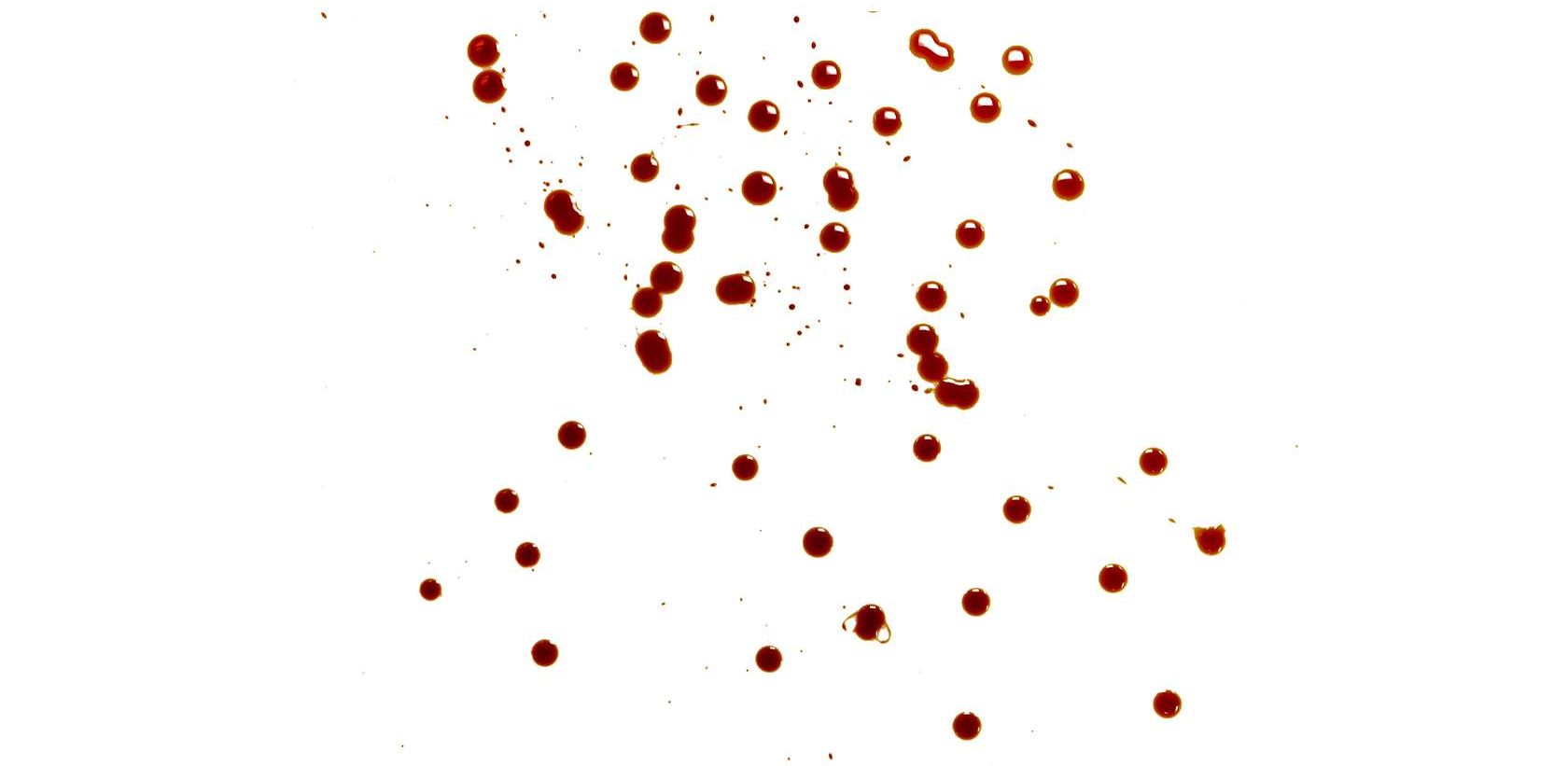 <p>When a droplet of blood is dropped directly from above and strikes a horizontal surface at 90°, it produces a circular stain.</p>