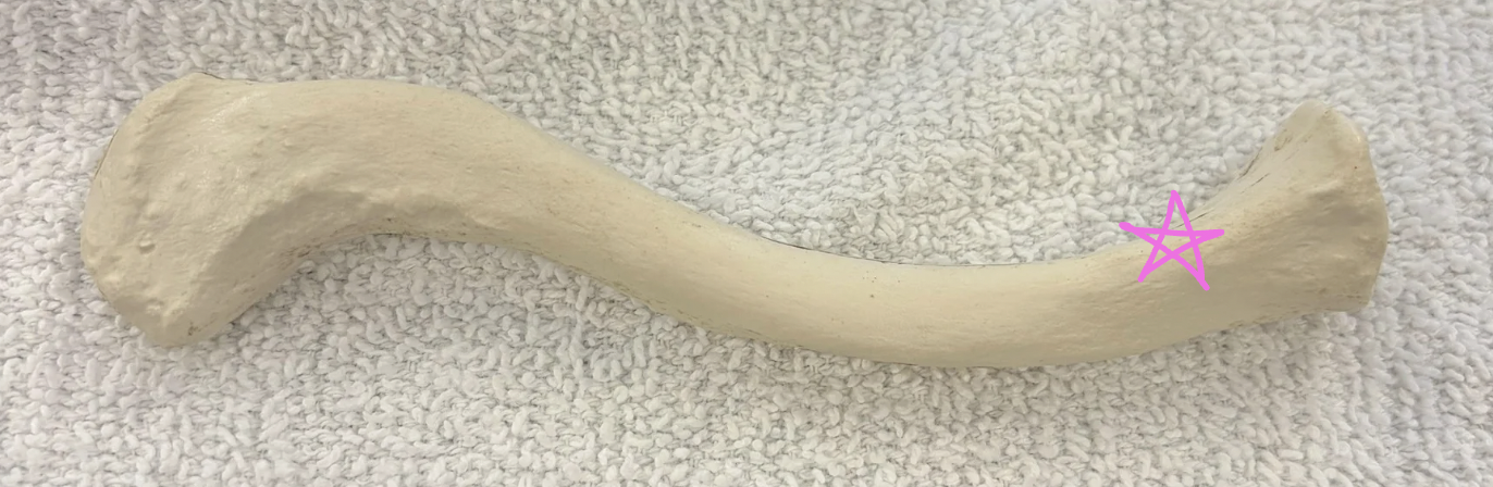 <p>What is this bone?</p><p>Pink star: What is this structure?</p><p>What muscle inserts here?</p>