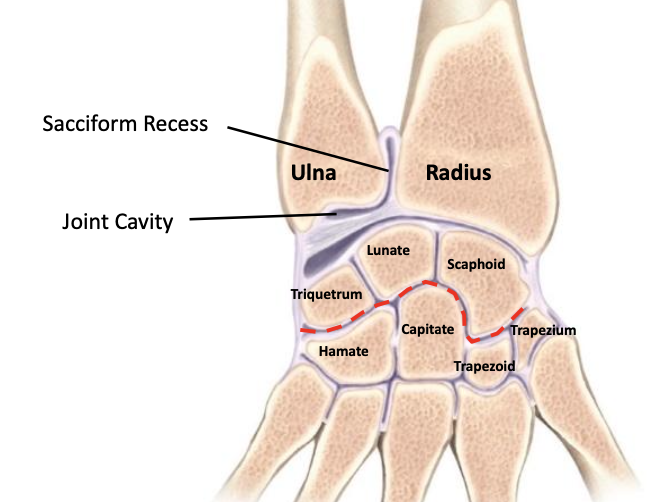 <p>Joint cavity is L shaped and extends superiorly between the radius and ulna<br>The fibrous capsule encloses the joint cavity front and back<br>Proximal capsule has a loose sack-shaped recess called the sacciform recess</p>