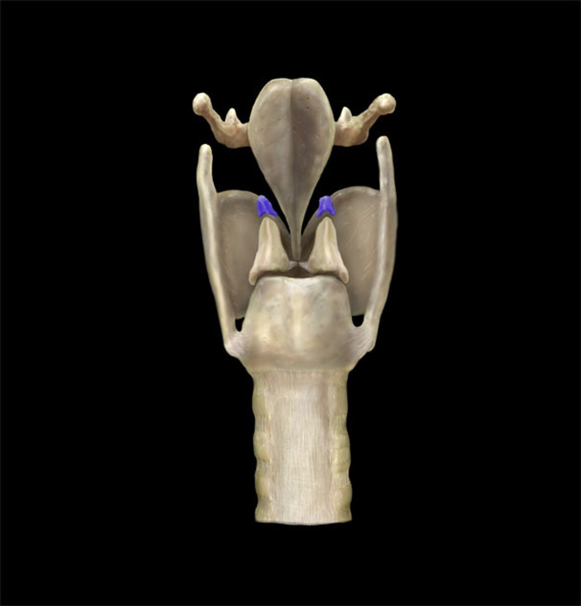 <p>name this</p>
