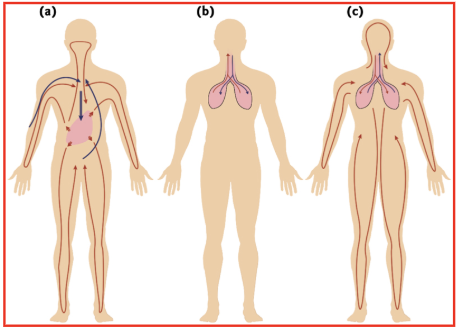<ol><li><p><span style="background-color: transparent;"><strong>Virus enters and circulates widely but can only infect cells in one location (example: Hepatitis B virus)</strong></span></p></li><li><p><span style="background-color: transparent;"><strong>&nbsp;Virus infect cells at the portal of entry (example: rhynovirus)</strong></span></p></li><li><p><span style="background-color: transparent;"><strong>Systemic infection (example: measles virus)</strong></span></p></li></ol><p></p>