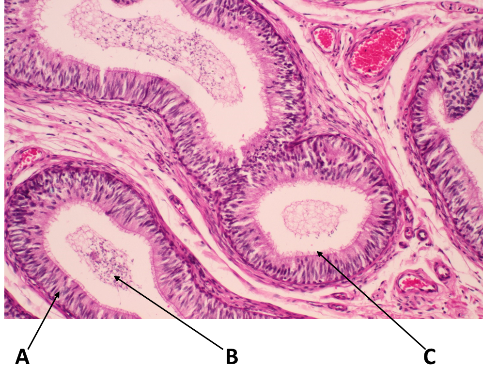 <p><span>Identify the type of tissue labeled with the letter A.</span></p>
