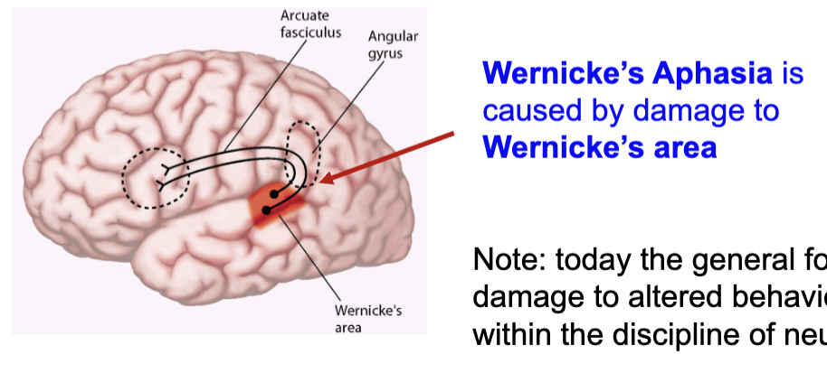 <p>Soon after Boca’s discovery, Wernicke described patient with </p><ul><li><p>Inability to comprehend speech</p></li><li><p>Normal hearing & language production</p></li><li><p>Similar patients subsequently seen with damage to posterior part of the superior gyrus</p></li></ul><p></p>