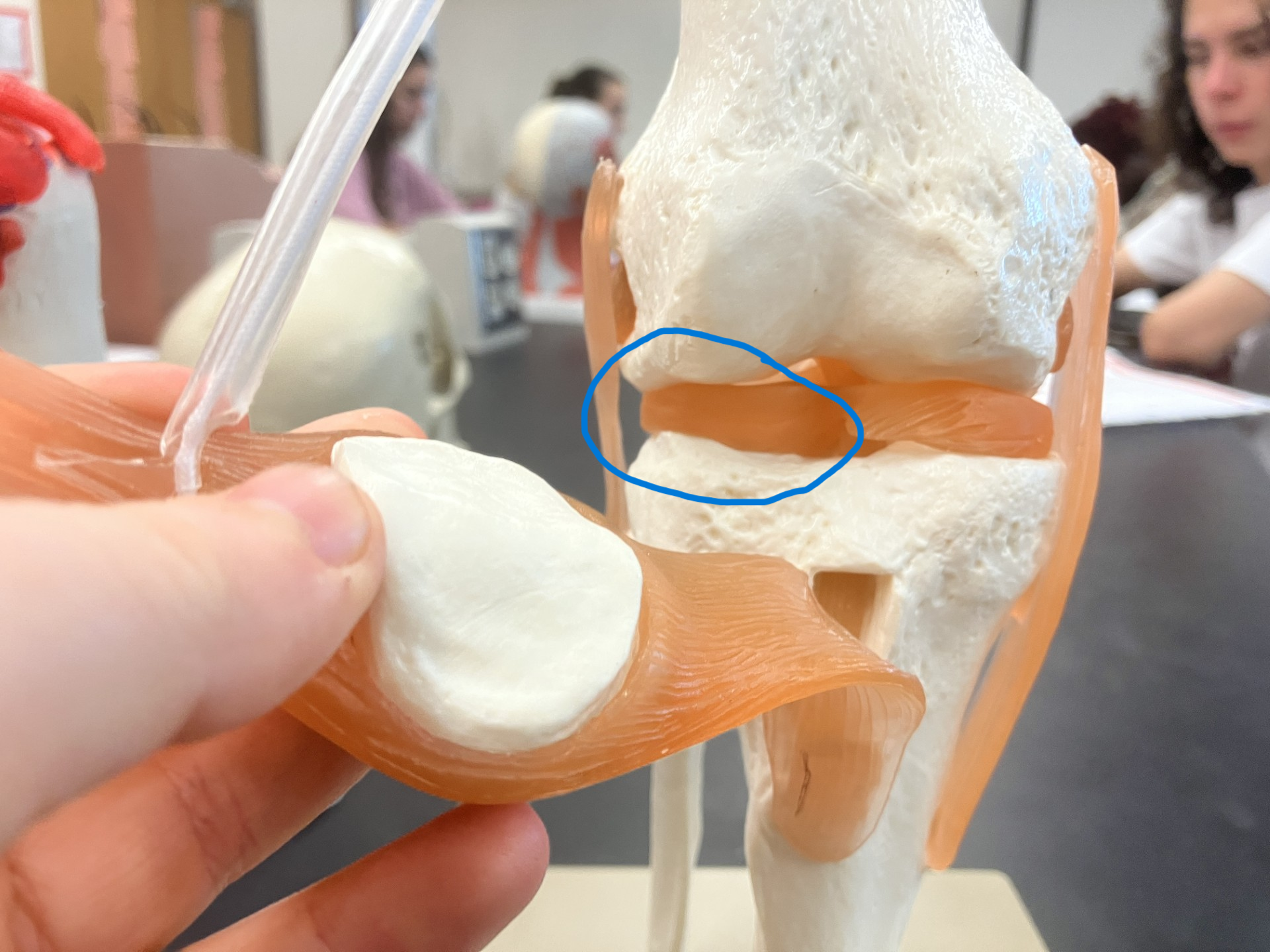 <p>C-shaped fibrocartilage between the femur and tibia</p>