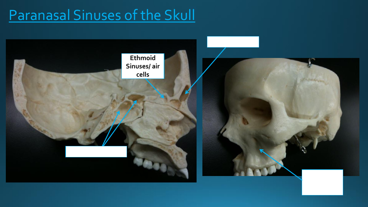 <p>Ethmoid Sinuses/air cells</p>