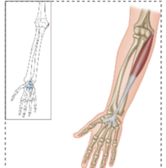<p>What muscle is highlighted?</p>