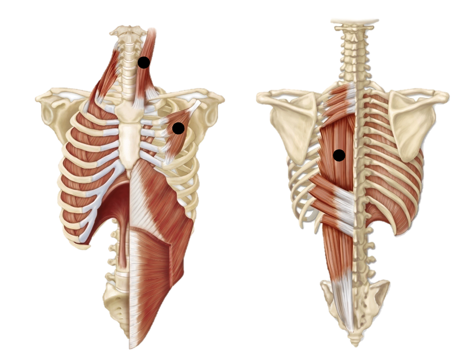 <p><span>Accessory muscles:</span><br><span>• Sternocleidomastoid</span><br><span>• Pectoralis minor</span><br><span>• Erector spinae</span><br><span>Increases thoracic cavity volume</span></p>