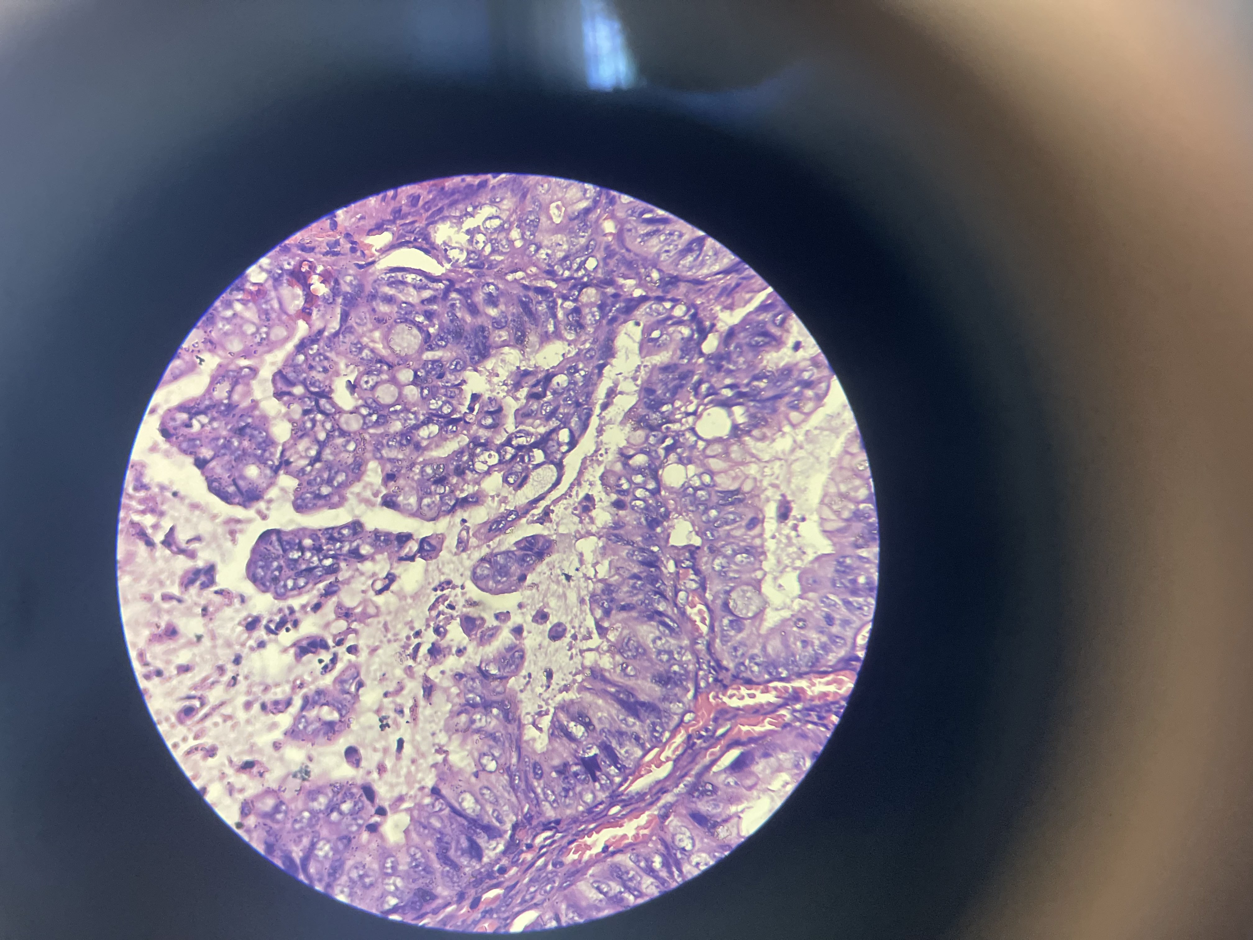 <p>What is the diagnosis?</p>