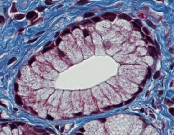 <p><span style="font-family: "Calibri Light";">Which type of epithelium lines the luminal surface of this structure?</span></p>