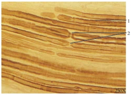 <p>A longitudinal section of axons</p>