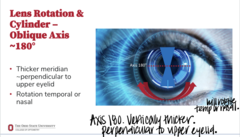 <p>When a CLs has an axis of 180º, the thicker meridian will be _____ to the upper eyelid</p>