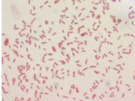 <p>What type of mastitis is depicted by this type of bacteria? </p>