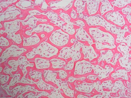 <p>Spongy Bone</p>