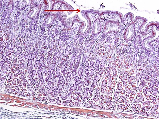 <p>Biểu mô gì ?</p>
