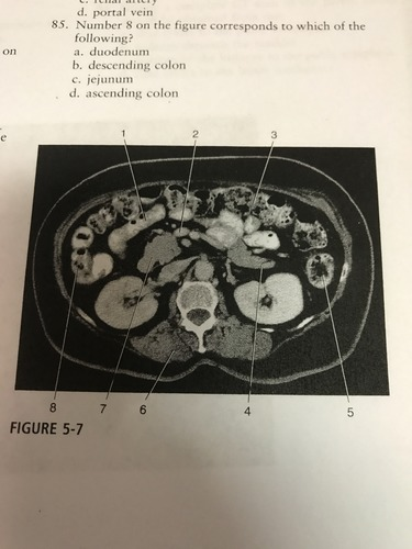 <p>Number 8 on the figure corresponds to which of the following?</p><p>A) duodenum</p><p>'B) descending colon</p><p>C) jejnum</p><p>D) ascending colon</p>