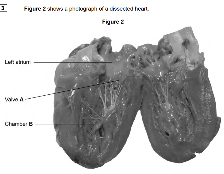 <p>Explain how valve <strong>A </strong>in Figure <strong>2</strong> maintains a unidirectional flow of blood</p>