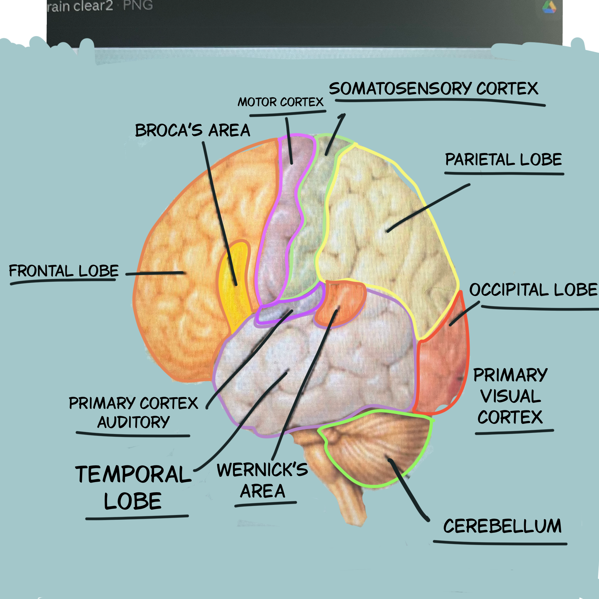 <p>Broca's area</p>