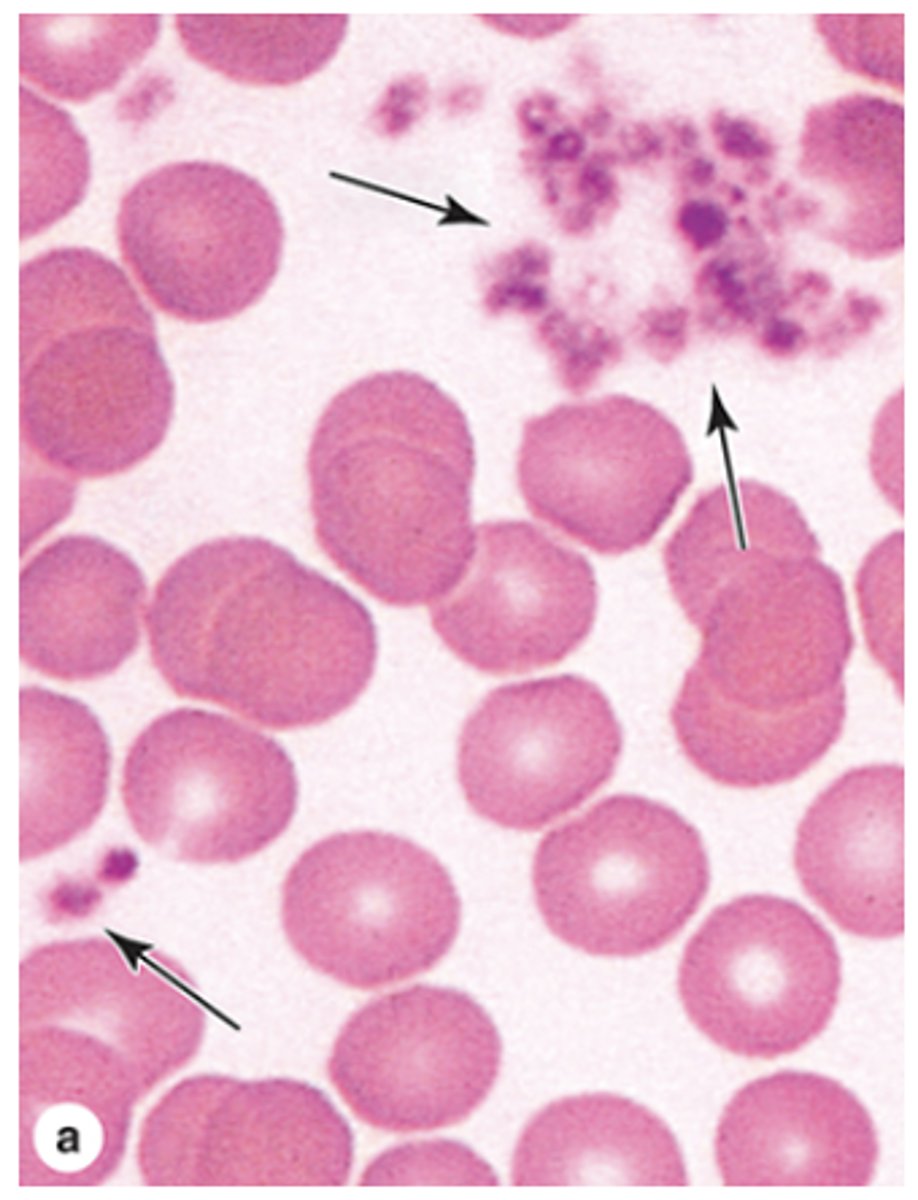 <p>Do platelets have a nucleus?</p>
