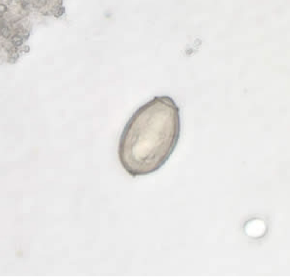 <p>-Eggs are about 30 microns</p><p>-Shouldered operculum</p><p>-Abopercular knob</p>