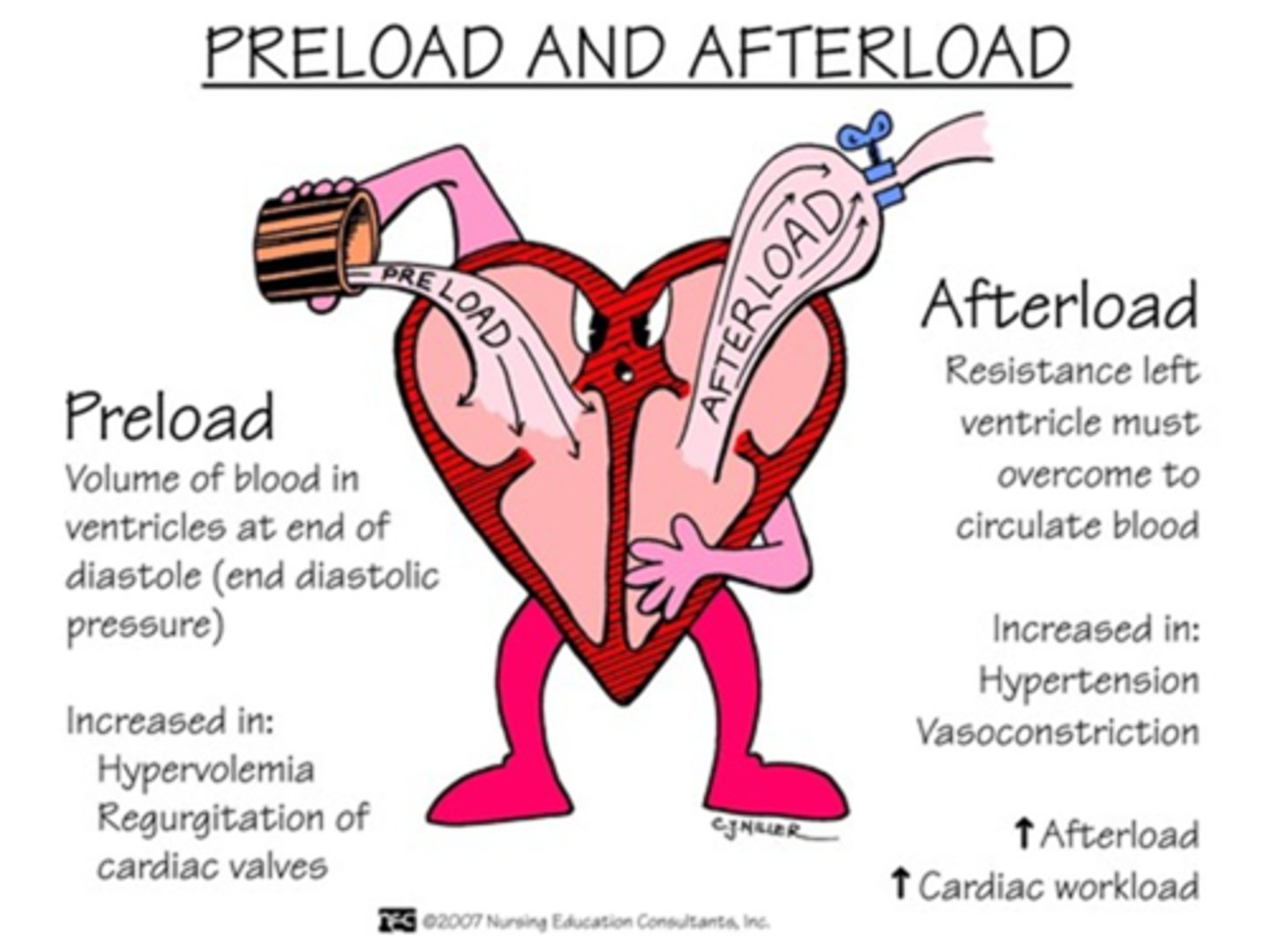 <p>A) The amount of pressure needed to pump blood out of the ventricles; the resistance the left ventricle must overcome to pump the blood into circulation</p>