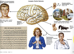 <p>one side of the brain, will experience an aura and loses awareness</p>