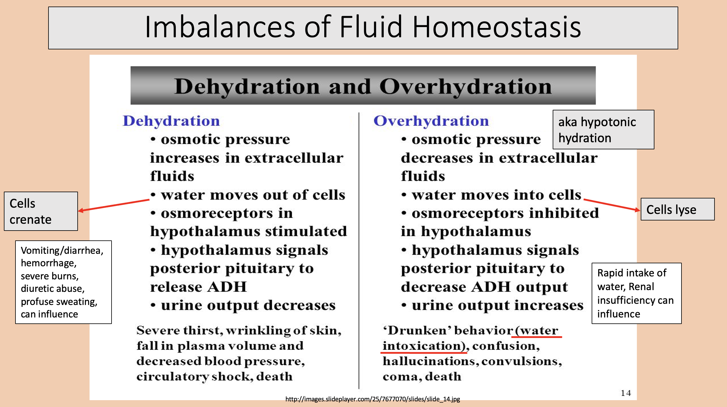<p>water intoxication </p>