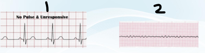 <p><em>NON-shockable</em> rhythms</p>