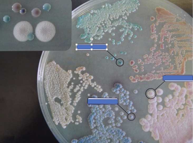 <p><span>Here is a ChromAgar plate. ID the green yeast</span></p>