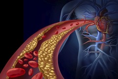 <p>They indicate cholesterol levels that are higher than needed, increasing the risk for atherosclerosis.</p>