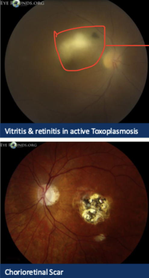 <p>Describe and give diagnosis </p>