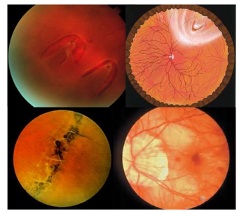 <p>Name the condition</p>