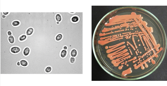<p>ID this yeast </p>