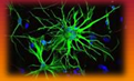 <p>which neuroglia cell is this?</p>