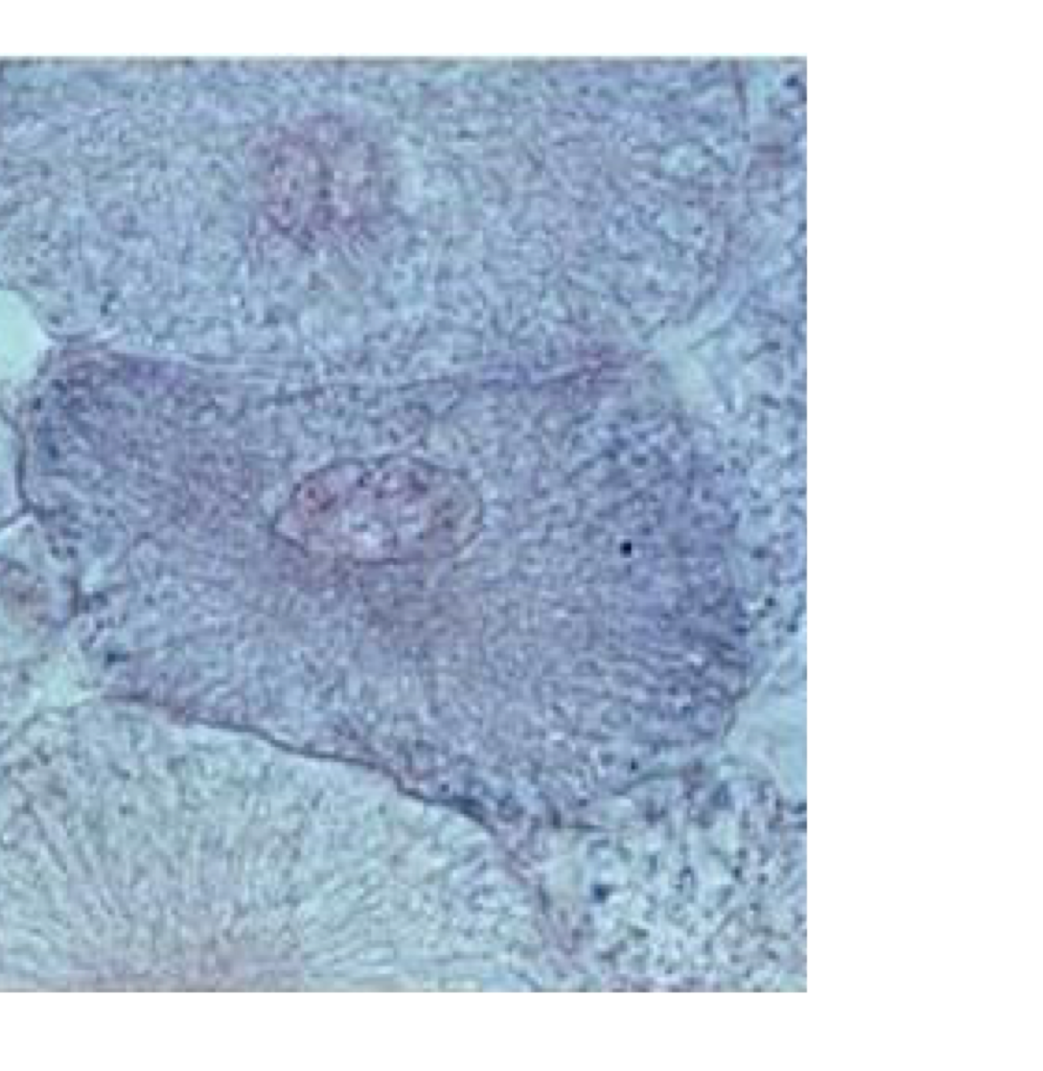 <p>What phase of mitosis is this?</p>