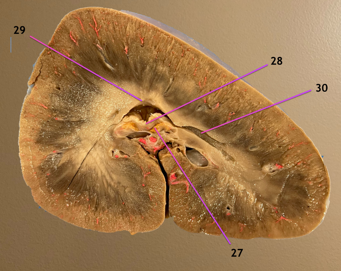 <p>longitudinal section of kidney</p><p>.</p><p>label 27-30</p><p>name the topographic region that 27 &amp; 28 sit in</p>