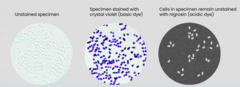 <p>Unstained bacteria are hard to see in a bright-field light microscope. Based on these images, what do you think the two stained specimens have in common? In both samples....</p><p> </p><p>the cells are dyed</p><p> </p><p>the contrast between the cells and background is decreased</p><p> </p><p>the contrast between the cells and background is increased</p><p> </p><p>the background is dyed</p>