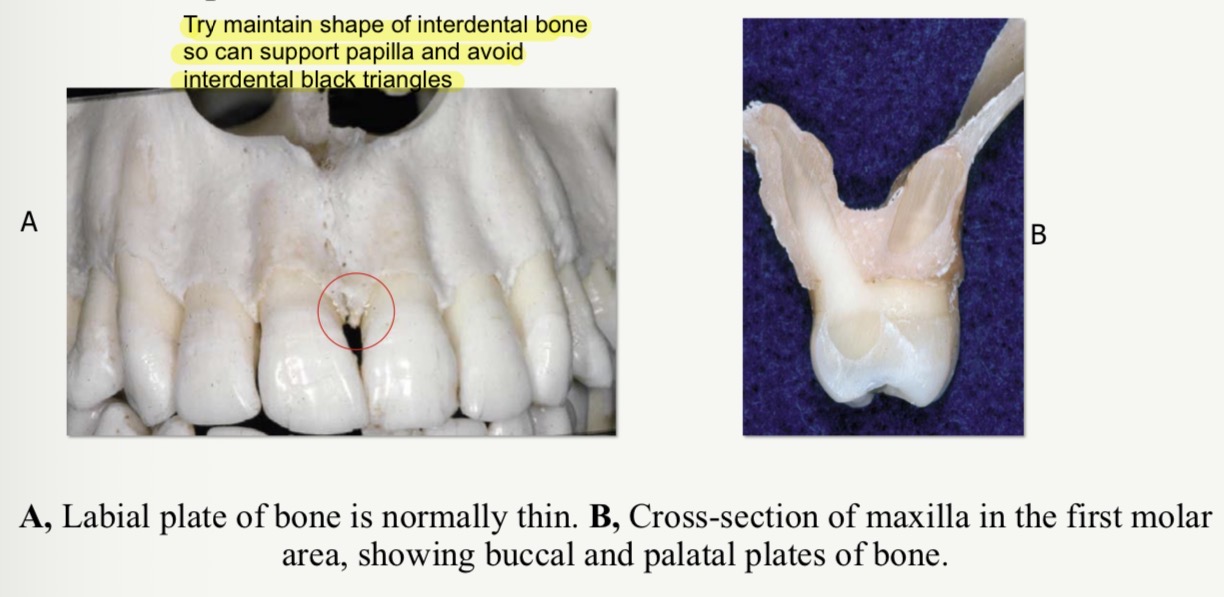 <p>No bc there’s a sig diff between interproximal bone contours of posteriors vs anteriors </p><p>Try maintain shape of interdental bone so can support papilla and avoid interdental black triangles </p>