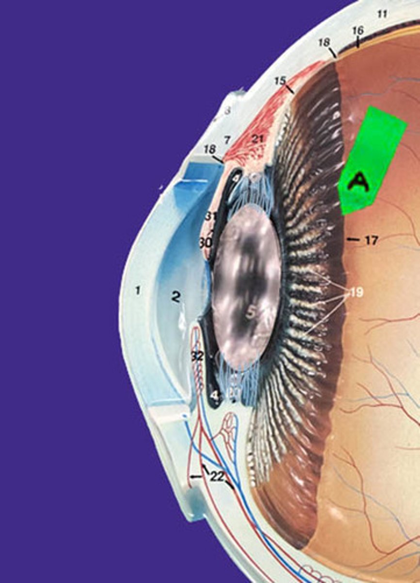 <p>Identify this structure (boundary).</p>