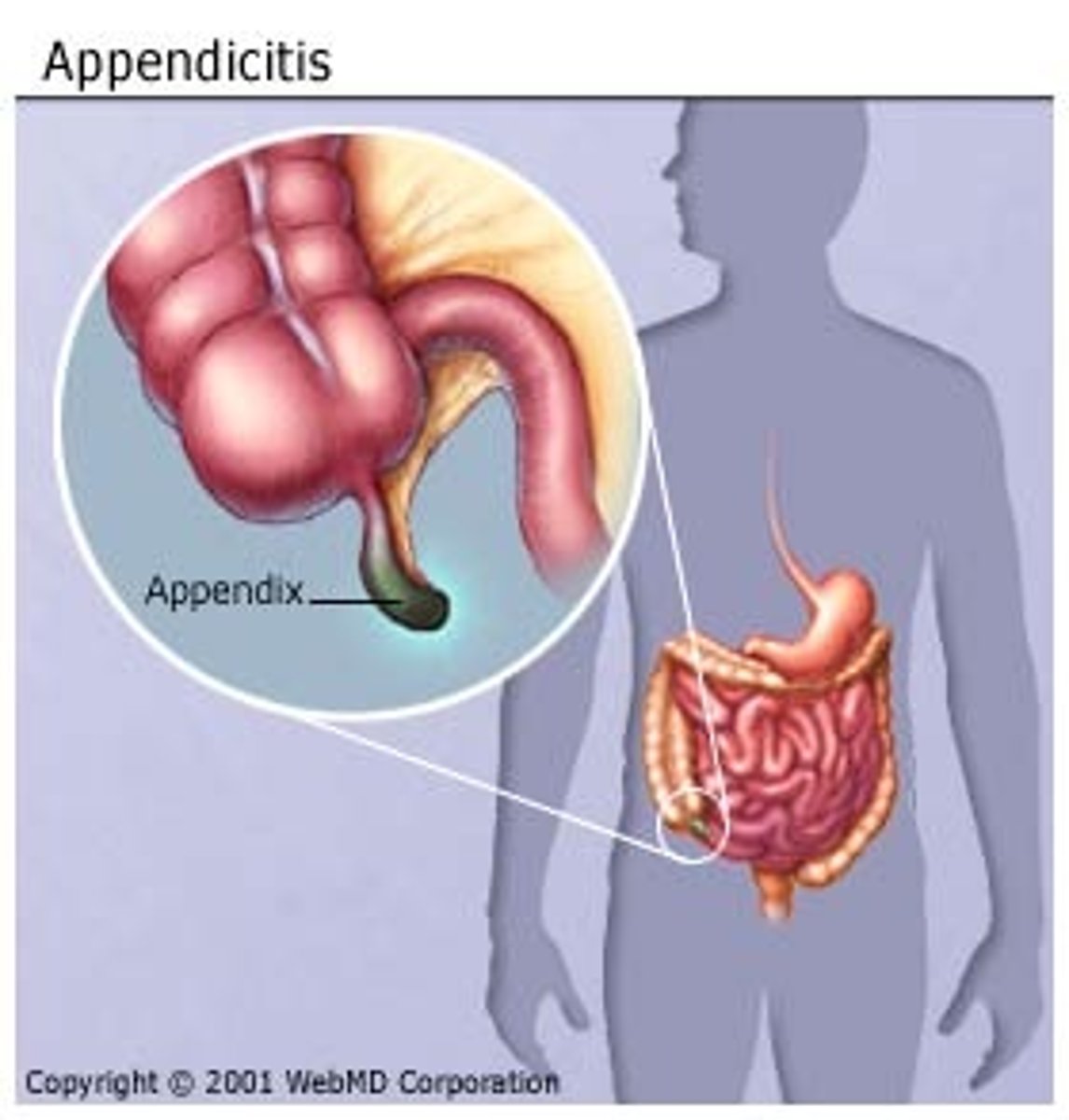 <p>append/o</p>