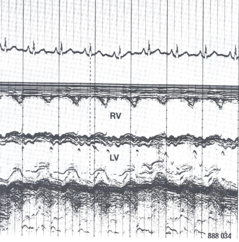 <p>lv m mode</p>