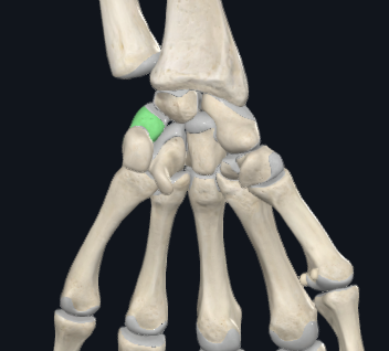 <p>what is this following bone and what section of the hand is it apart of?</p>