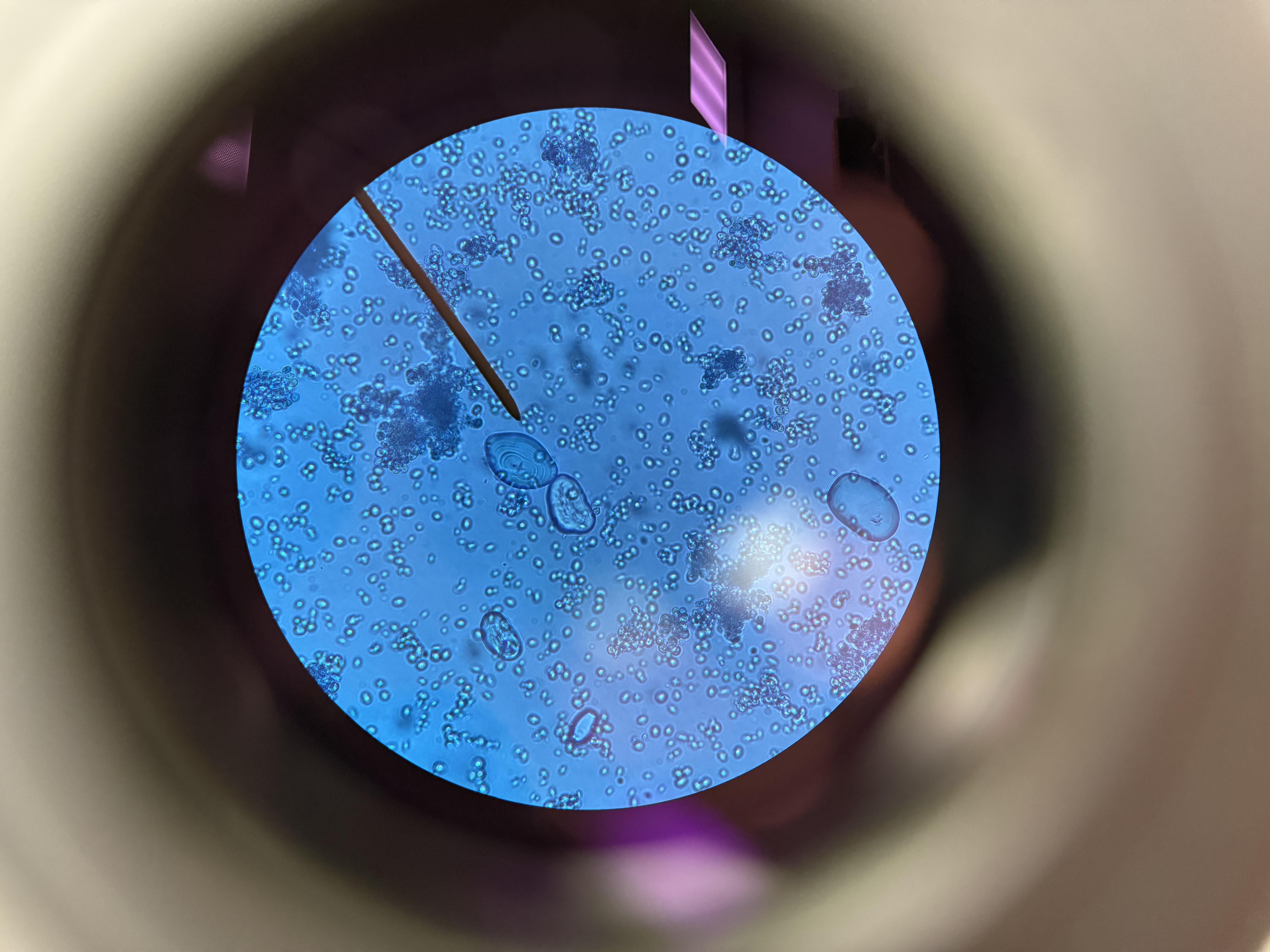 <ol><li><p>What is this?</p></li><li><p>What is the pointer pointing at?</p></li><li><p>Is there any budding?</p></li><li><p>Autotrophic or Heterotrophic</p></li><li><p>Unicellular or multicellular?</p></li></ol><p></p>