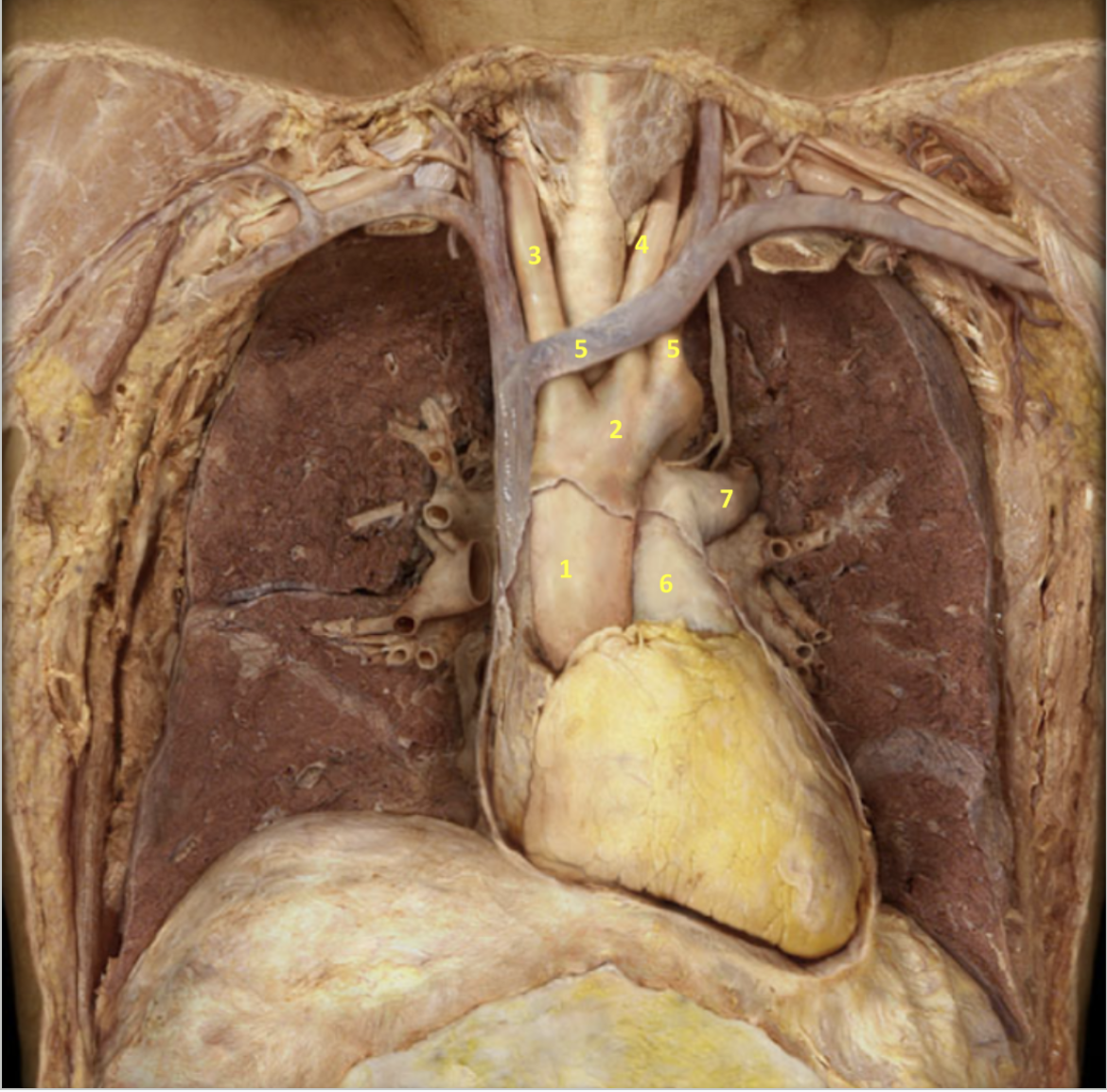 <p>Thorax - Deep Dissection</p><p>1. Ascending aorta</p><p>2. Aortic arch</p><p>3. Brachiocephalic artery</p><p>4. Left common carotid artery</p><p>5. Left subclavian artery</p><p>6. Pulmonary trunk</p><p>7. Left pulmonary artery</p>