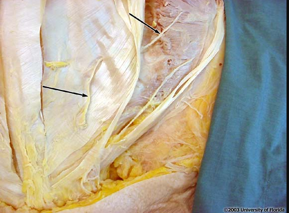 <p>what nerve is being indicated to in the image; context: this is the deep surface of the external abdominal oblique along with the surface of the internal abdominal oblique muscle</p>