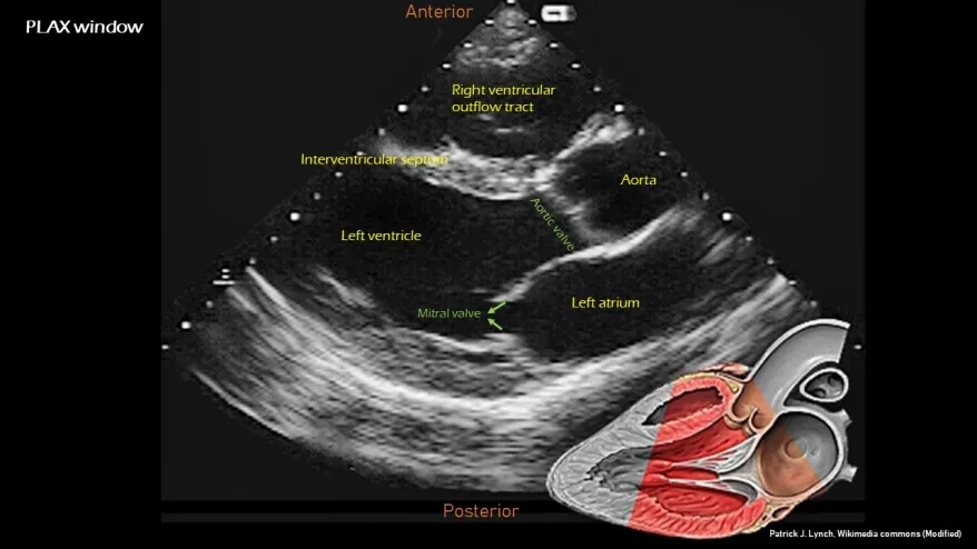 <p>For this image define the probe location, index mark orientation, and how to obtain this image.</p>
