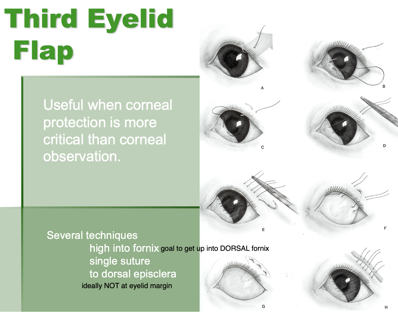 <p> corneal protection is more critical than corneal observation.</p>