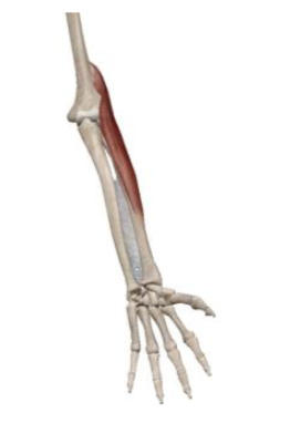 <p>what muscle and action is this </p>