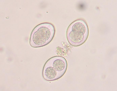 <p>What parasite is this?</p>