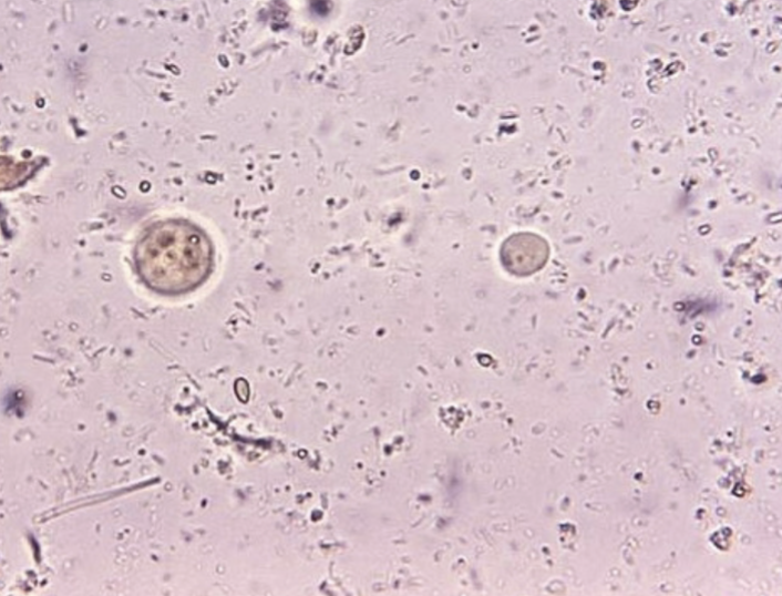 <p>What protist/cyst is this?</p>
