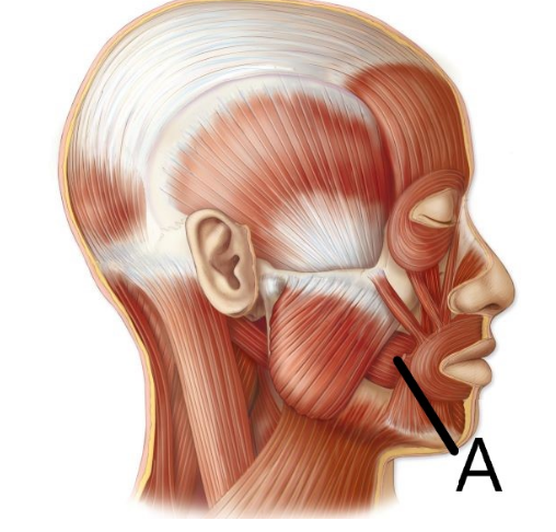<p>what is this facial muscle</p>